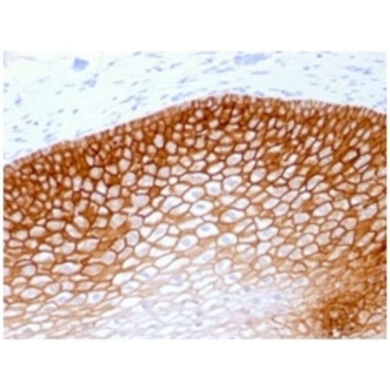 Immunohistochemistry - Anti-CD44v4 Antibody [rCD44v4/1219] (A250705) - Antibodies.com