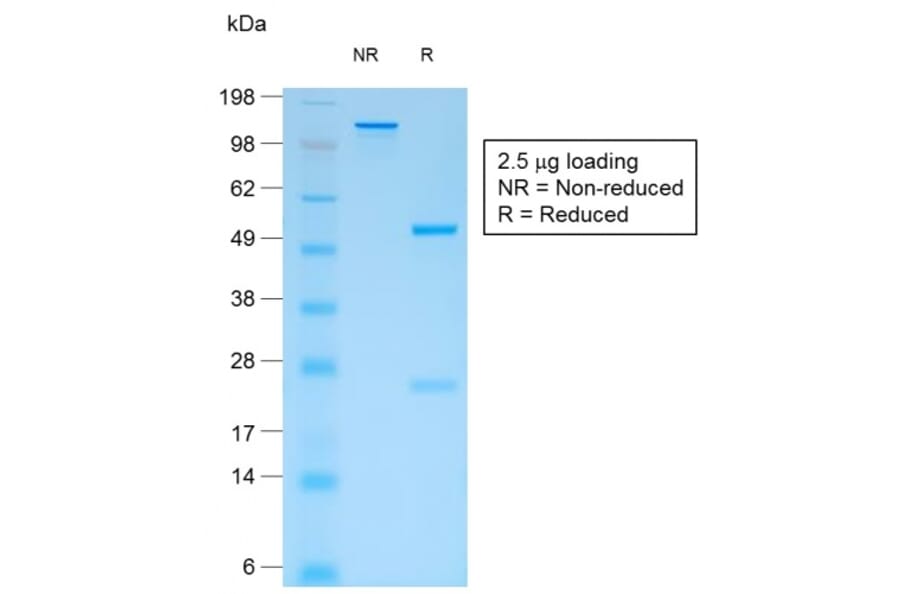 SDS-PAGE - Anti-CD44v4 Antibody [rCD44v4/1219] (A250705) - Antibodies.com