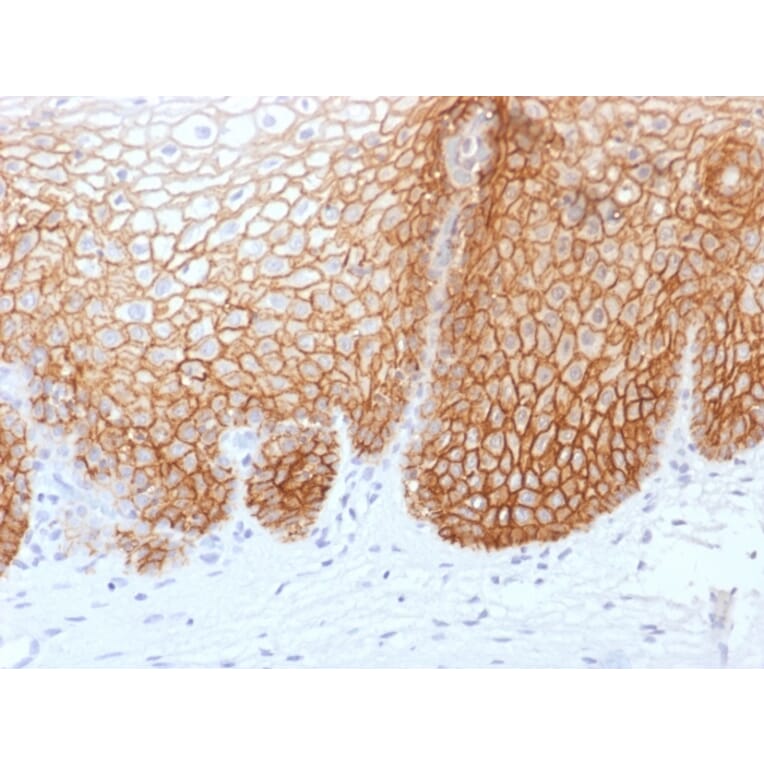 Immunohistochemistry - Anti-CD44v9 Antibody [rCD44v9/1459] (A250705) - Antibodies.com