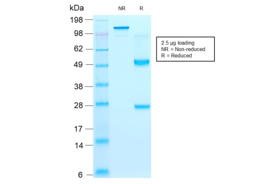 SDS-PAGE - Anti-CD44v9 Antibody [rCD44v9/1459] (A250706) - Antibodies.com