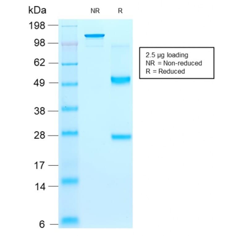 SDS-PAGE - Anti-CD44v9 Antibody [rCD44v9/1459] (A250706) - Antibodies.com
