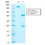 SDS-PAGE - Anti-CD44v9 Antibody [rCD44v9/1459] (A250706) - Antibodies.com