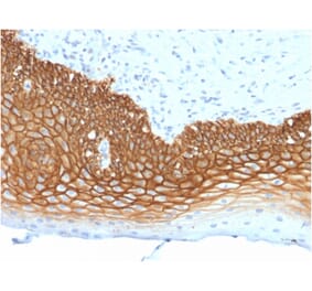 Immunohistochemistry - Anti-CD44v3 Antibody [3G5] (A250706) - Antibodies.com