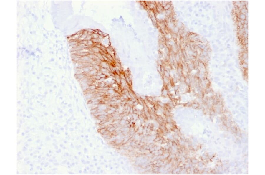 Immunohistochemistry - Anti-CD44v6 Antibody [CD44V6/2496] (A250707) - Antibodies.com