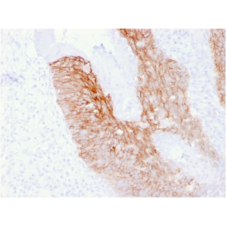 Immunohistochemistry - Anti-CD44v6 Antibody [CD44V6/2496] (A250707) - Antibodies.com