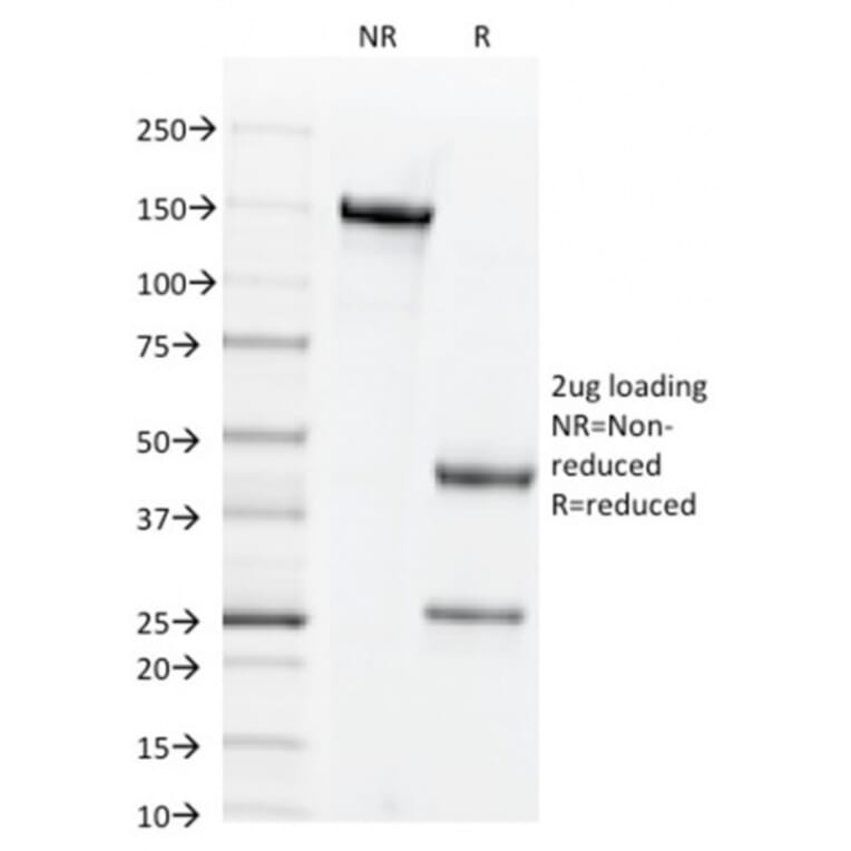 SDS-PAGE - Anti-CD44v6 Antibody [CD44V6/2496] (A250708) - Antibodies.com