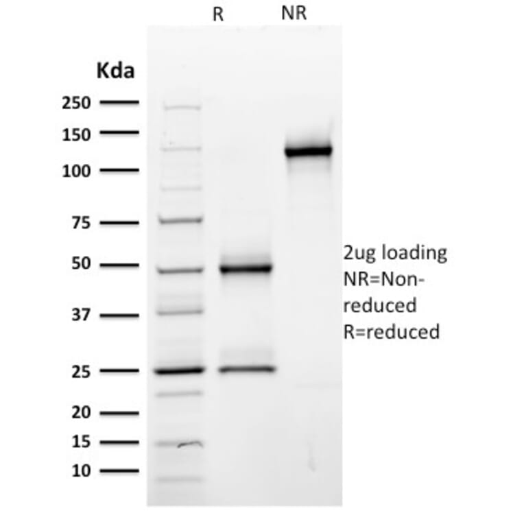 SDS-PAGE - Anti-CD44 Antibody [BU75] (A250709) - Antibodies.com