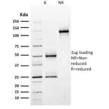 SDS-PAGE - Anti-CD44 Antibody [BU75] (A250709) - Antibodies.com