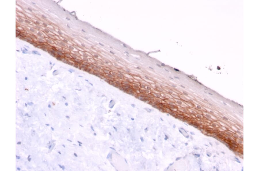 Immunohistochemistry - Anti-CD44v4/5 Antibody [3D2] (A250710) - Antibodies.com