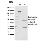 SDS-PAGE - Anti-CD44v4/5 Antibody [3D2] (A253885) - Antibodies.com