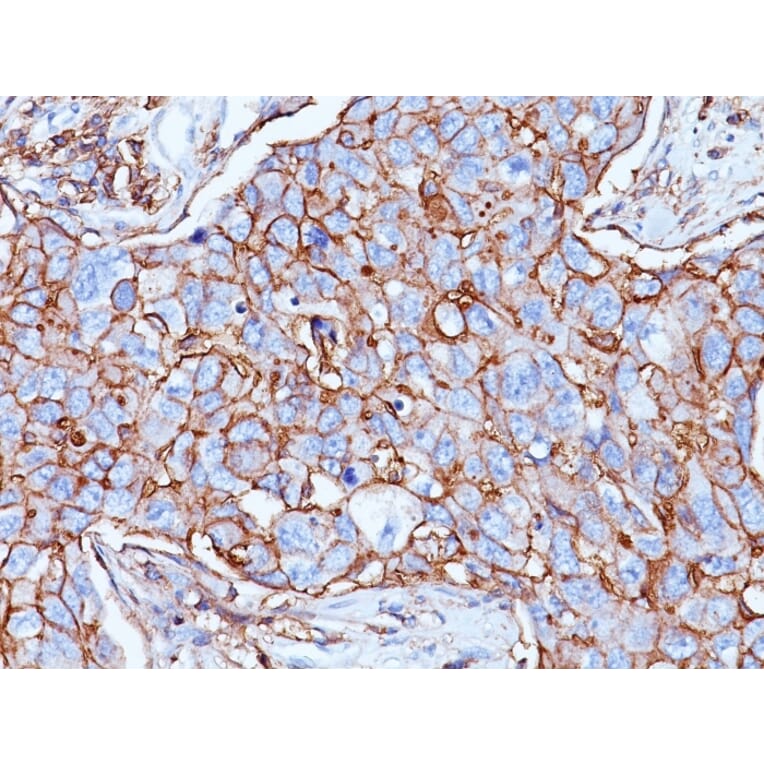 Immunohistochemistry - Anti-CD44 Antibody [156-3C11] (A250711) - Antibodies.com