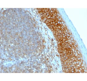 Immunohistochemistry - Anti-CD44 Antibody [SPM544] (A250711) - Antibodies.com