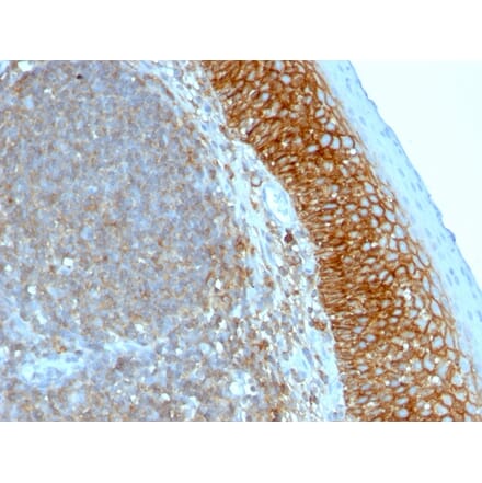 Immunohistochemistry - Anti-CD44 Antibody [SPM544] (A250711) - Antibodies.com