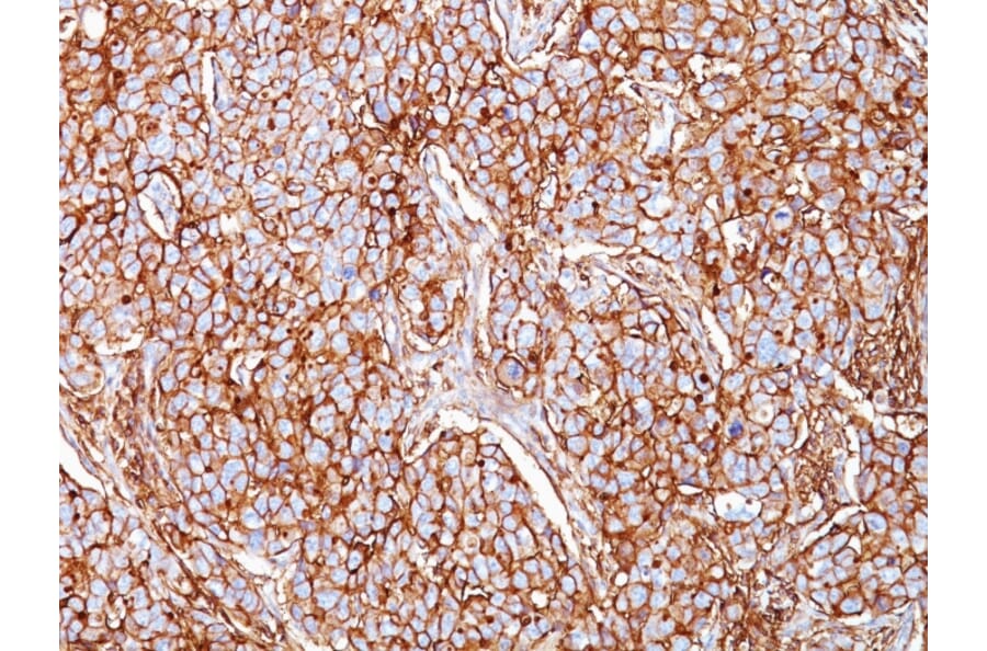 Immunohistochemistry - Anti-CD44 Antibody [SPM521] (A250712) - Antibodies.com