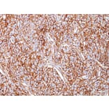Immunohistochemistry - Anti-CD44 Antibody [SPM521] (A250712) - Antibodies.com