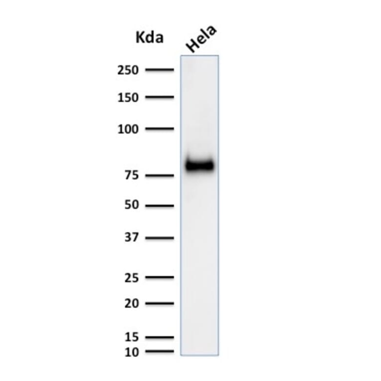 Western Blot - Anti-CD44 Antibody [SPM521] (A250713) - Antibodies.com