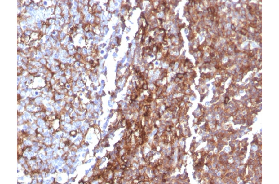 Immunohistochemistry - Anti-CD44 Antibody [rHCAM/918] (A250714) - Antibodies.com