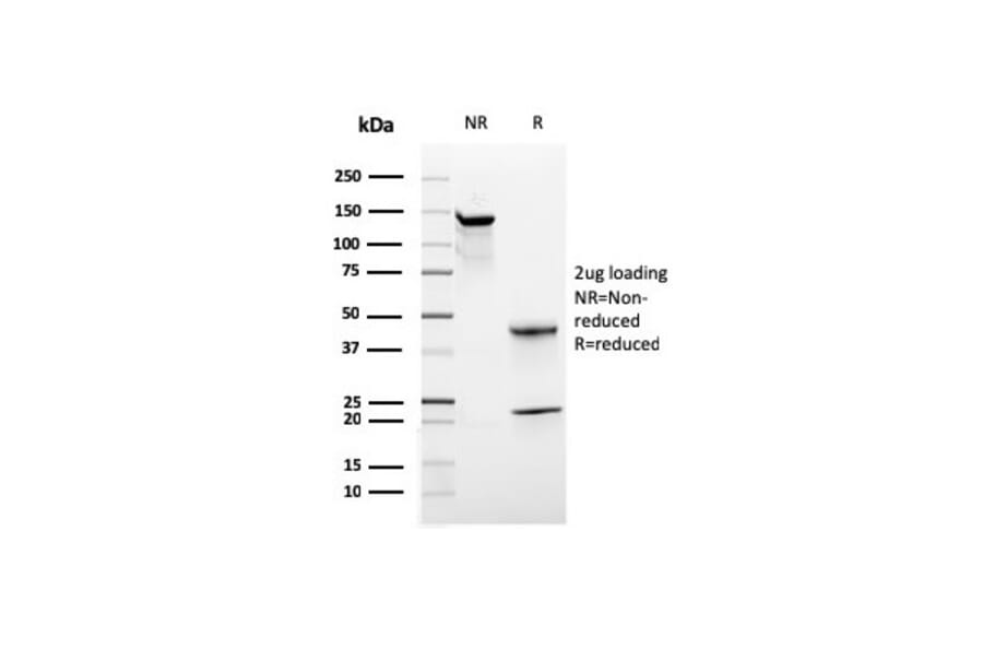 SDS-PAGE - Anti-CD44 Antibody [rHCAM/918] (A250714) - Antibodies.com