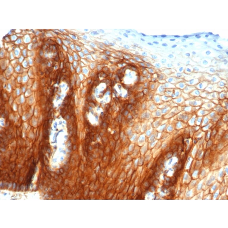 Immunohistochemistry - Anti-CD44 Antibody [rHCAM/6449] (A253905) - Antibodies.com