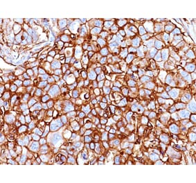 Immunohistochemistry - Anti-CD44 Antibody [HCAM/918] (A250716) - Antibodies.com