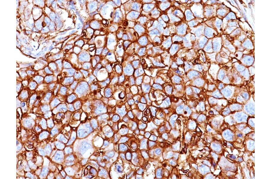Immunohistochemistry - Anti-CD44 Antibody [HCAM/918] (A250716) - Antibodies.com