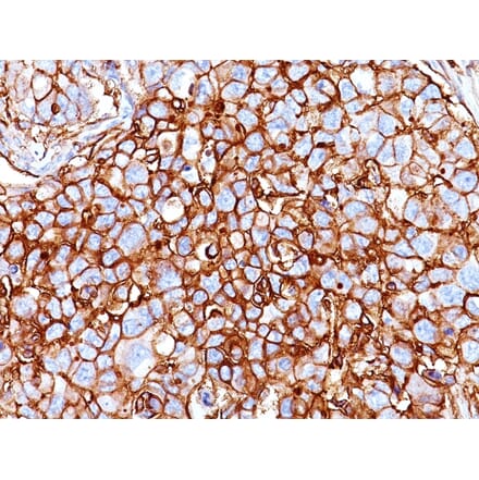 Immunohistochemistry - Anti-CD44 Antibody [HCAM/918] (A250716) - Antibodies.com