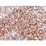 Immunohistochemistry - Anti-CD44 Antibody [HCAM/918] (A250716) - Antibodies.com
