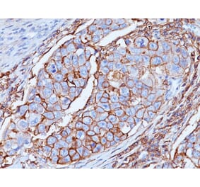 Immunohistochemistry - Anti-CD44 Antibody [DF1485] (A251506) - Antibodies.com