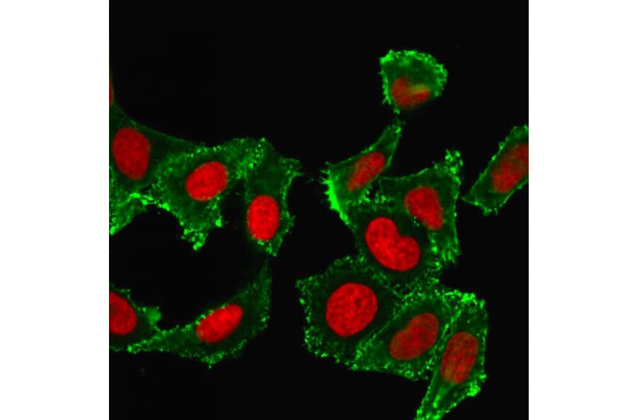 Immunofluorescence - Anti-CD44 Antibody [DF1485] (A250716) - Antibodies.com