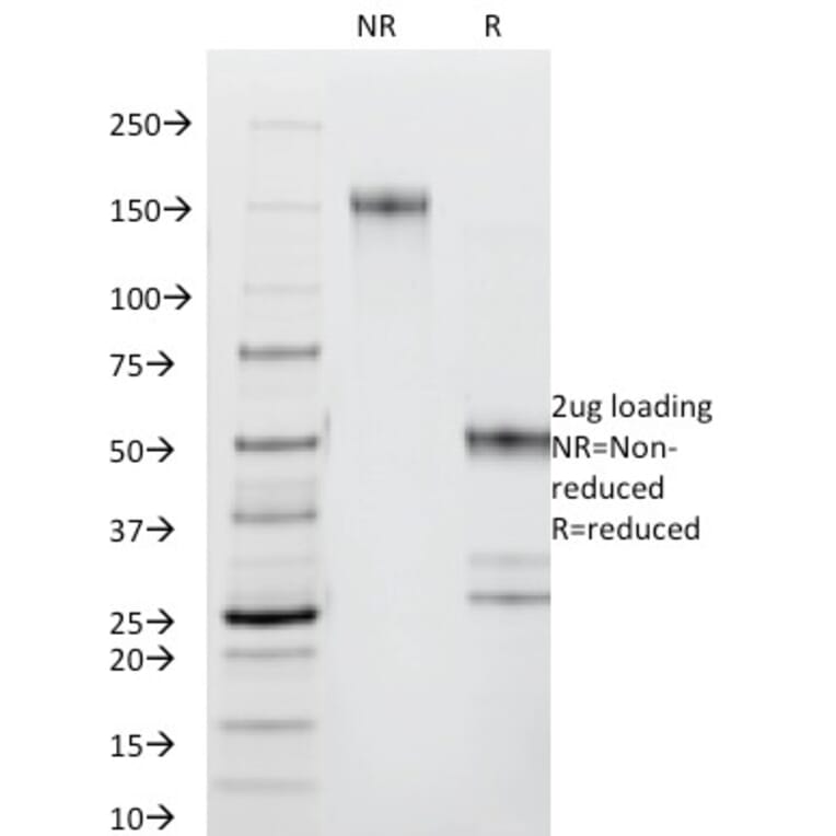 SDS-PAGE - Anti-CD44 Antibody [DF1485] (A250717) - Antibodies.com