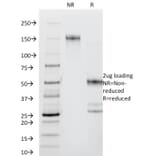 SDS-PAGE - Anti-CD44 Antibody [DF1485] (A250717) - Antibodies.com