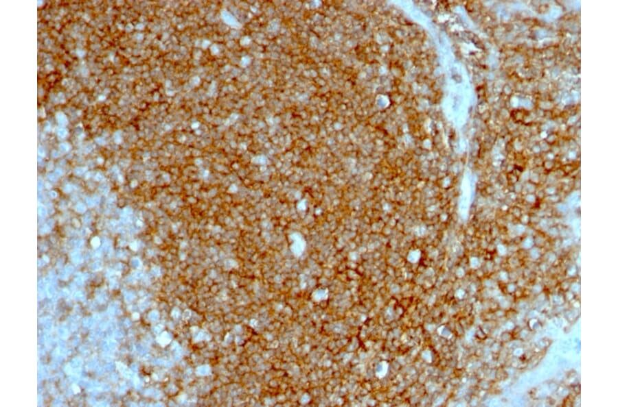 Immunohistochemistry - Anti-CD44 Antibody [HCAM/1097] (A250717) - Antibodies.com