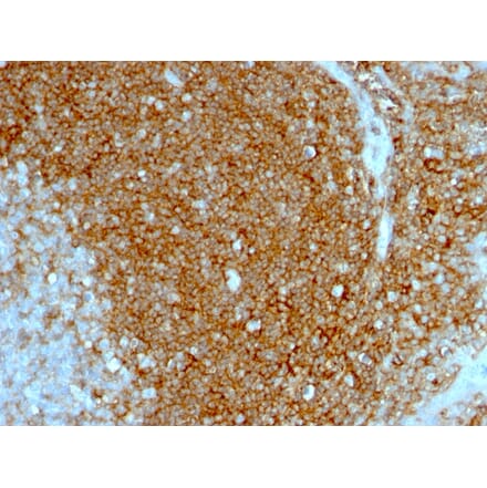 Immunohistochemistry - Anti-CD44 Antibody [HCAM/1097] (A250717) - Antibodies.com