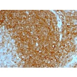 Immunohistochemistry - Anti-CD44 Antibody [HCAM/1097] (A250717) - Antibodies.com