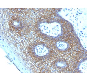 Immunohistochemistry - Anti-CD44v4 Antibody [CD44v4/1219] (A250718) - Antibodies.com