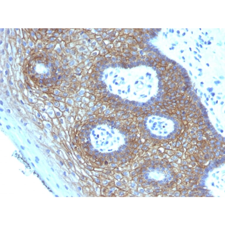 Immunohistochemistry - Anti-CD44v4 Antibody [CD44v4/1219] (A250718) - Antibodies.com