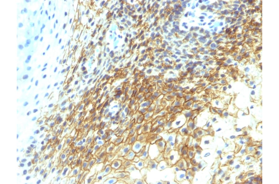 Immunohistochemistry - Anti-CD44v4 Antibody [CD44v4/1219] (A250719) - Antibodies.com