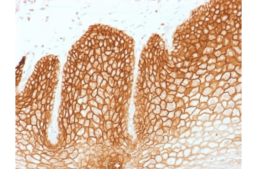 Immunohistochemistry - Anti-CD44v6 Antibody [CD44v6/1246] (A250719) - Antibodies.com