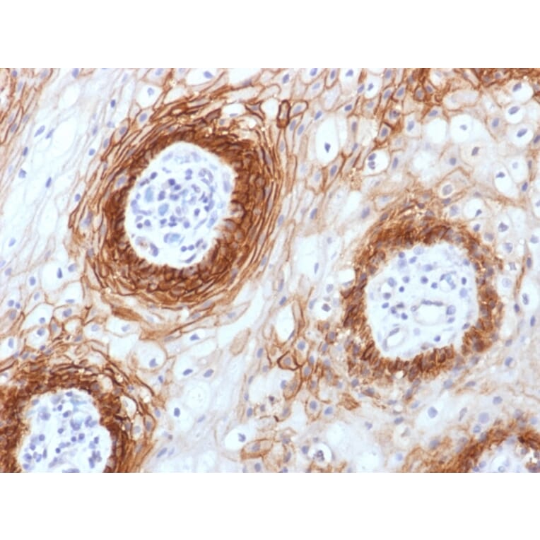 Immunohistochemistry - Anti-CD44v6 Antibody [CD44v6/1246] (A250720) - Antibodies.com