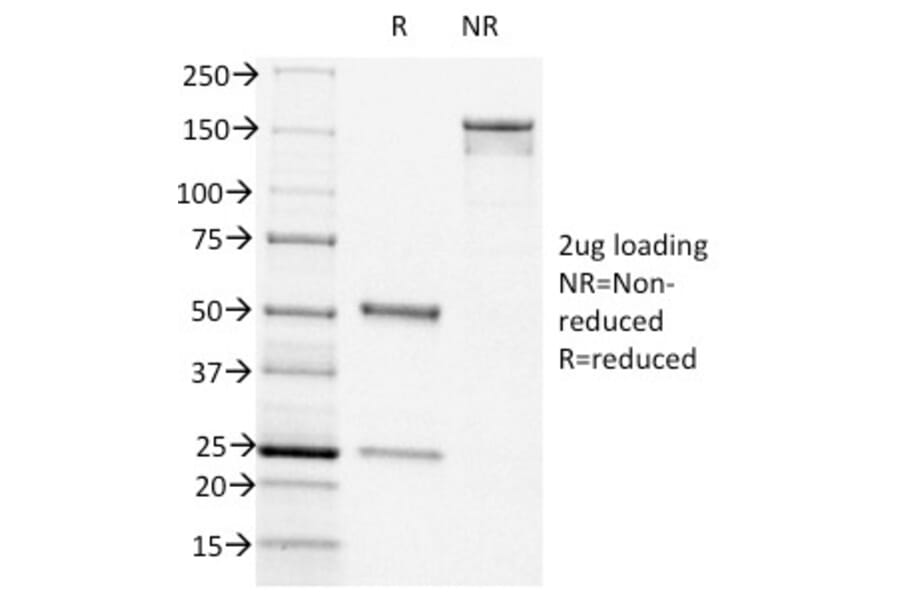 SDS-PAGE - Anti-CD44v6 Antibody [CD44v6/1246] (A250720) - Antibodies.com