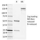 SDS-PAGE - Anti-CD44v6 Antibody [CD44v6/1246] (A250720) - Antibodies.com