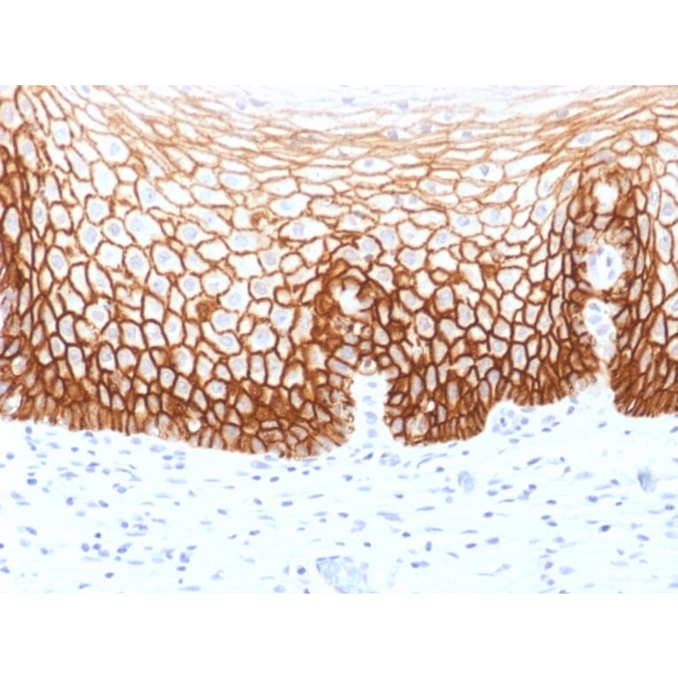 Immunohistochemistry - Anti-CD44v9 Antibody [CD44v9/1459] (A250720) - Antibodies.com