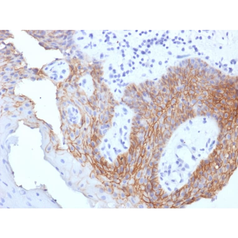 Immunohistochemistry - Anti-CD44v9 Antibody [CD44v9/1459] (A250721) - Antibodies.com