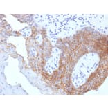 Immunohistochemistry - Anti-CD44v9 Antibody [CD44v9/1459] (A250721) - Antibodies.com