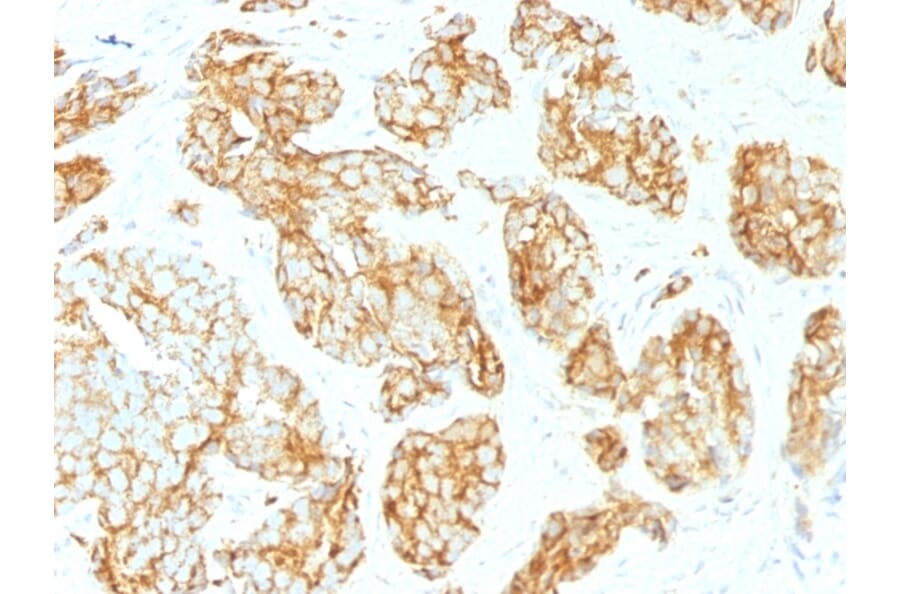 Immunohistochemistry - Anti-CD44v9 Antibody [CD44v9/1459] (A250721) - Antibodies.com