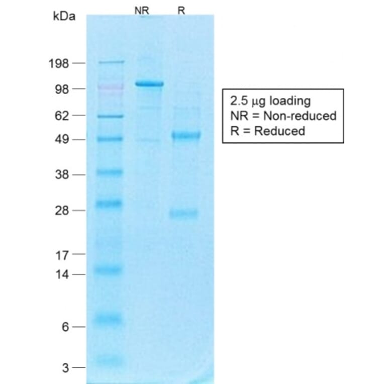 SDS-PAGE - Anti-CD44v4 Antibody [CD44v4/1700R] (A250722) - Antibodies.com