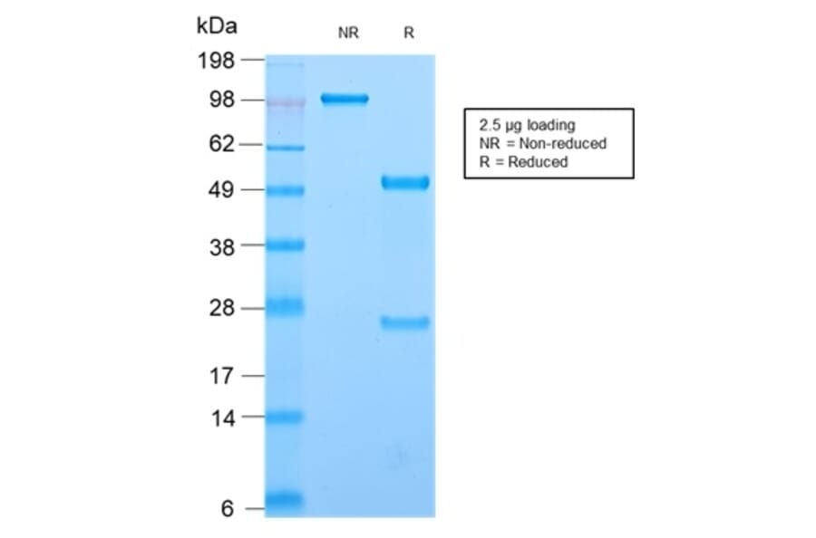 SDS-PAGE - Anti-CD44 Antibody [HCAM/2875R] (A250723) - Antibodies.com