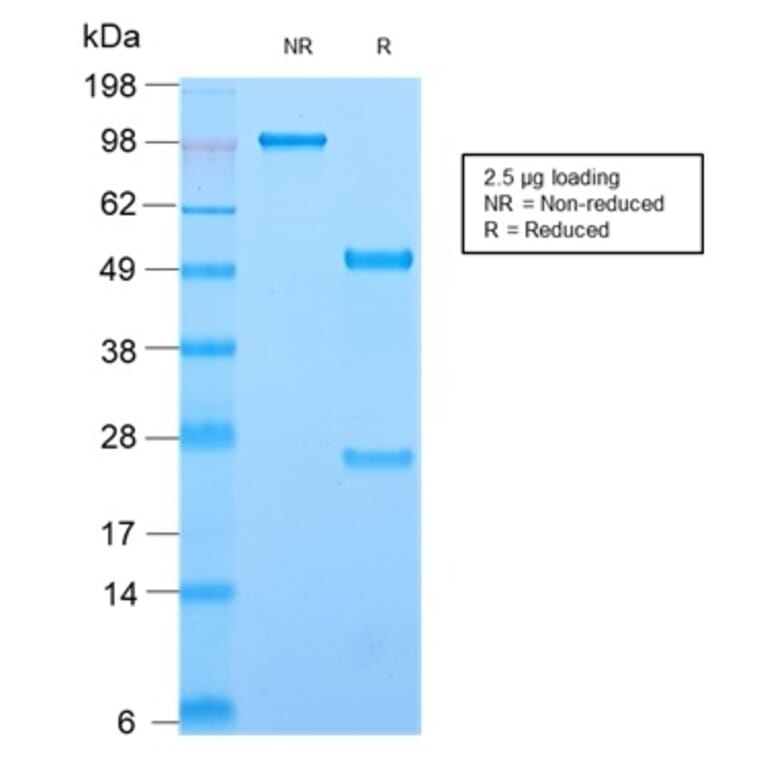 SDS-PAGE - Anti-CD44 Antibody [HCAM/2875R] (A250723) - Antibodies.com