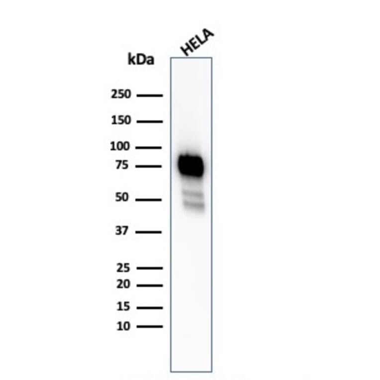 Western Blot - Anti-CD44 Antibody [HCAM/2875R] (A250723) - Antibodies.com