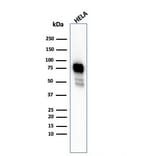 Western Blot - Anti-CD44 Antibody [HCAM/2875R] (A250723) - Antibodies.com